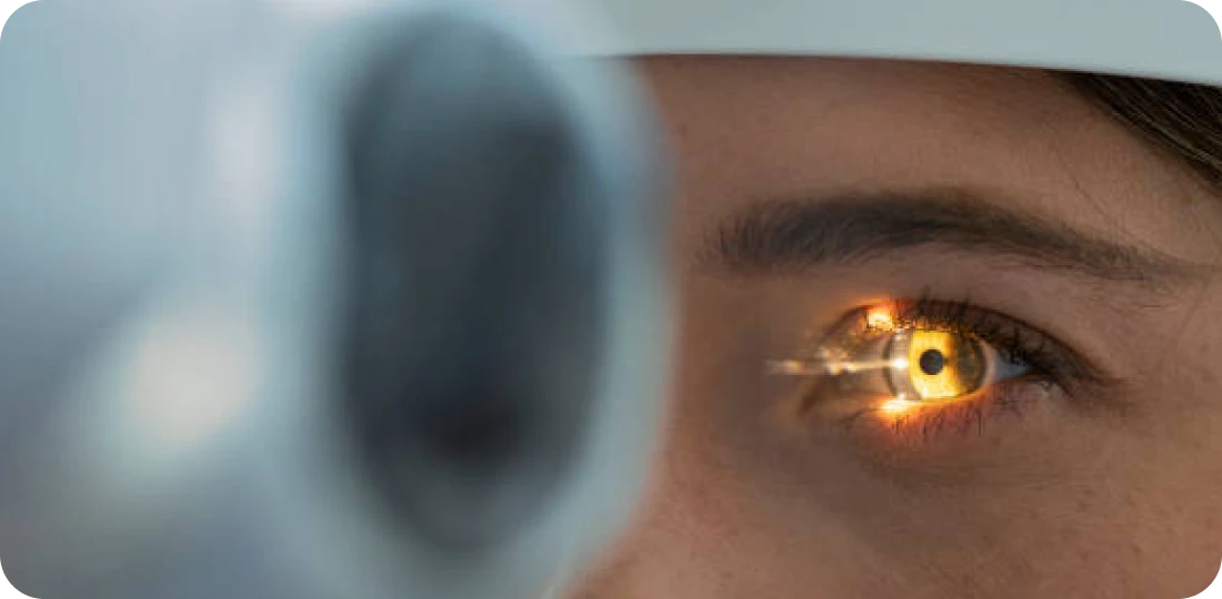 Close-up of an eye during an eye exam