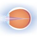 ActivControl® Technology