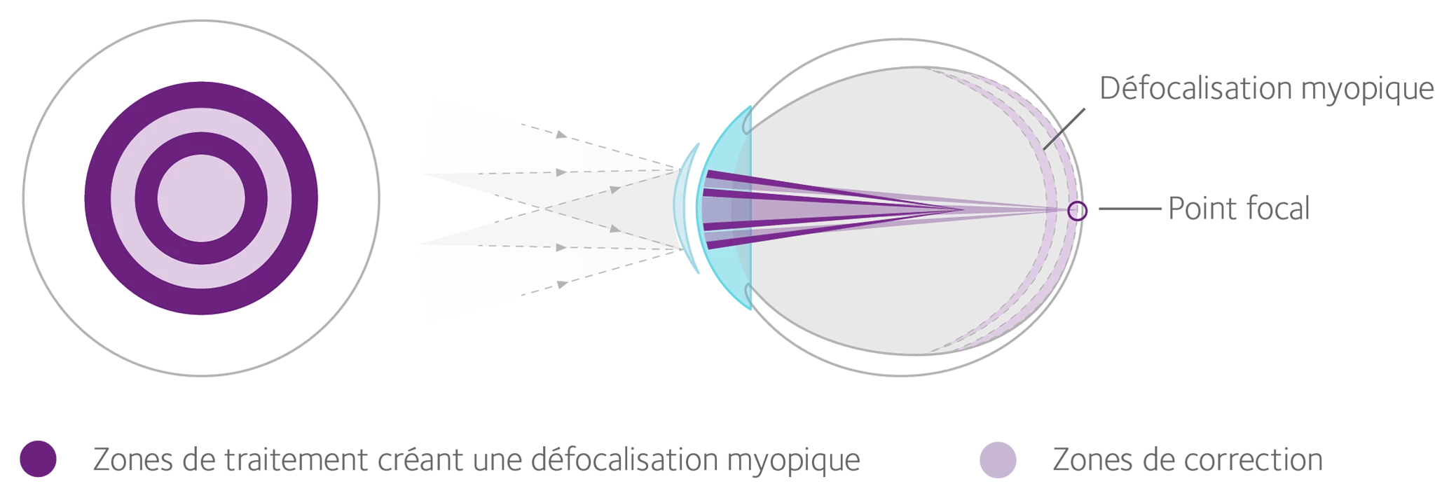 How lenses work