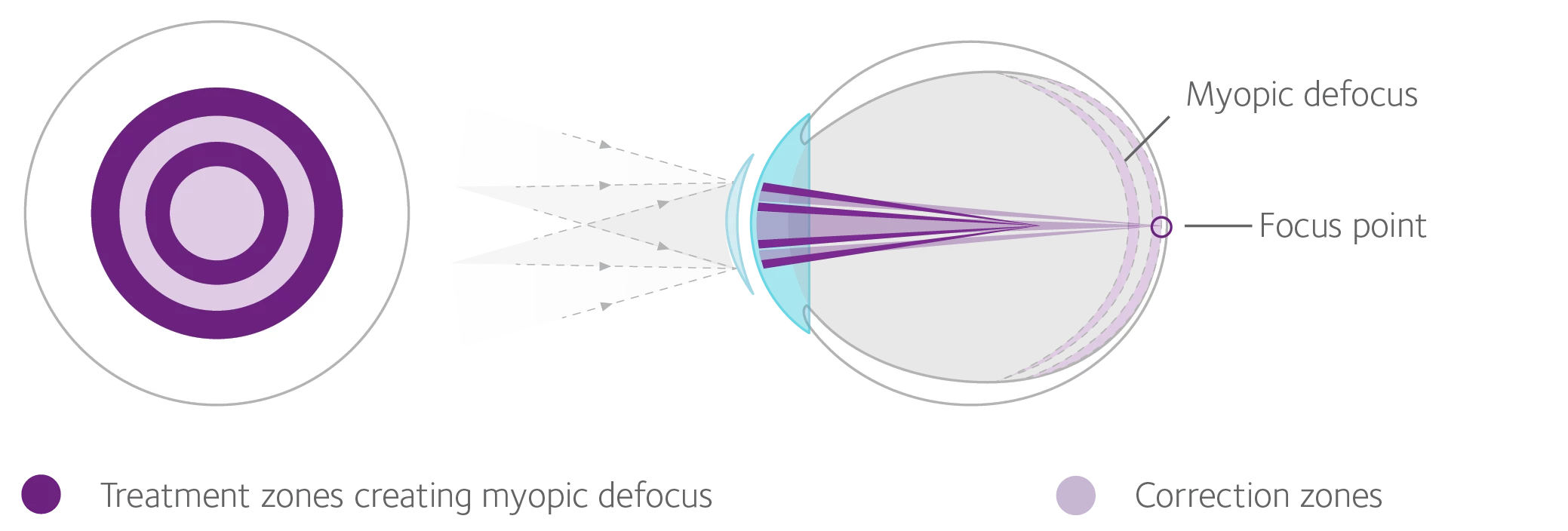 How lenses work