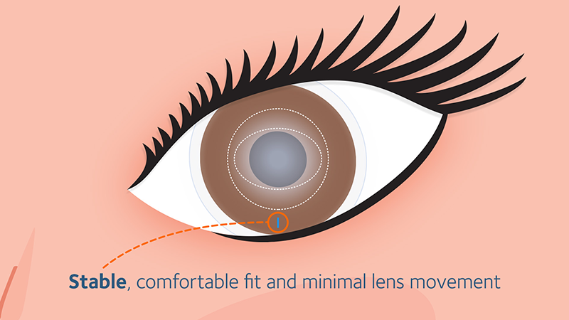 Optimised Toric Lens Geometry™